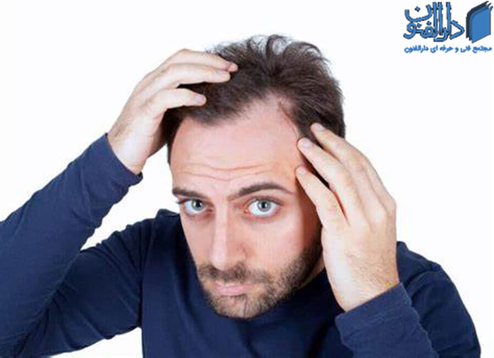 رفع چربی موی سر : چگونه می توان مشکل موهای چرب را رفع کرد