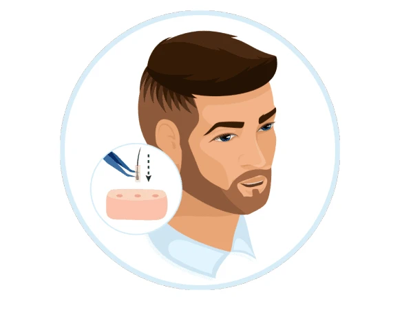 چطور ریشمان را پرپشت کنیم؟